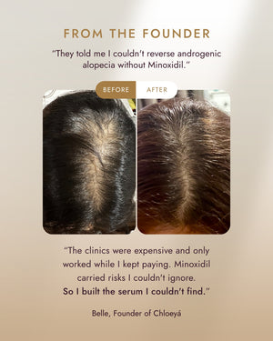 Belle, founder of Chloeya, on why she built the serum, with her own before and after