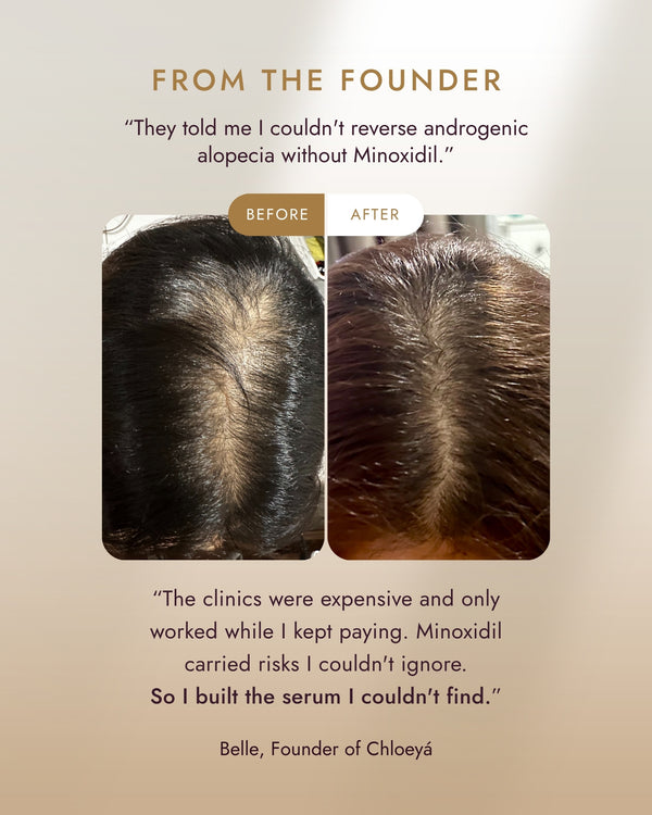 Belle, founder of Chloeya, on why she built the serum, with her own before and after