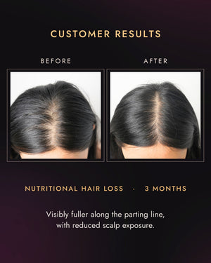 Customer part line before and after three months, nutritional hair loss