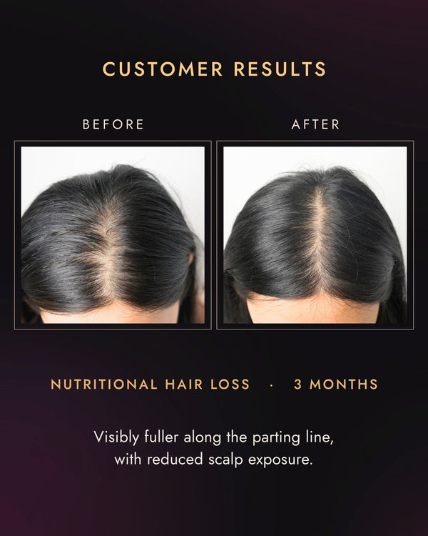 Customer part line before and after three months, nutritional hair loss