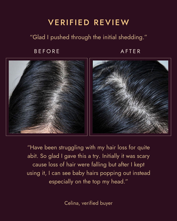 Verified review from Celina with her own before and after photos