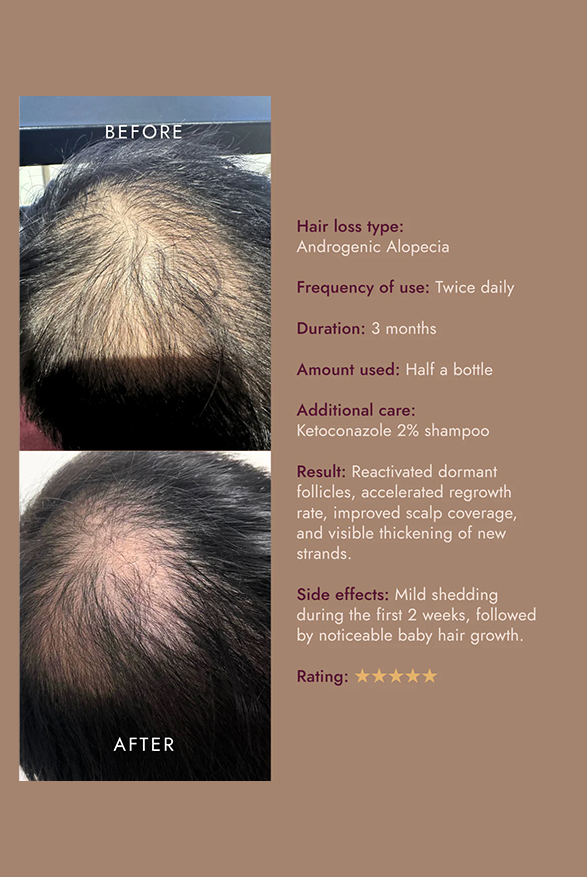 The Alpha Hair Serum