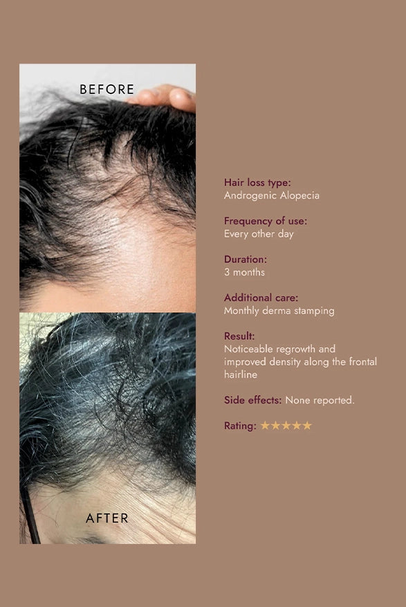 The Alpha Hair Serum