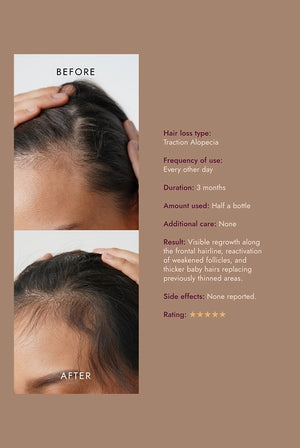 The Alpha Hair Serum