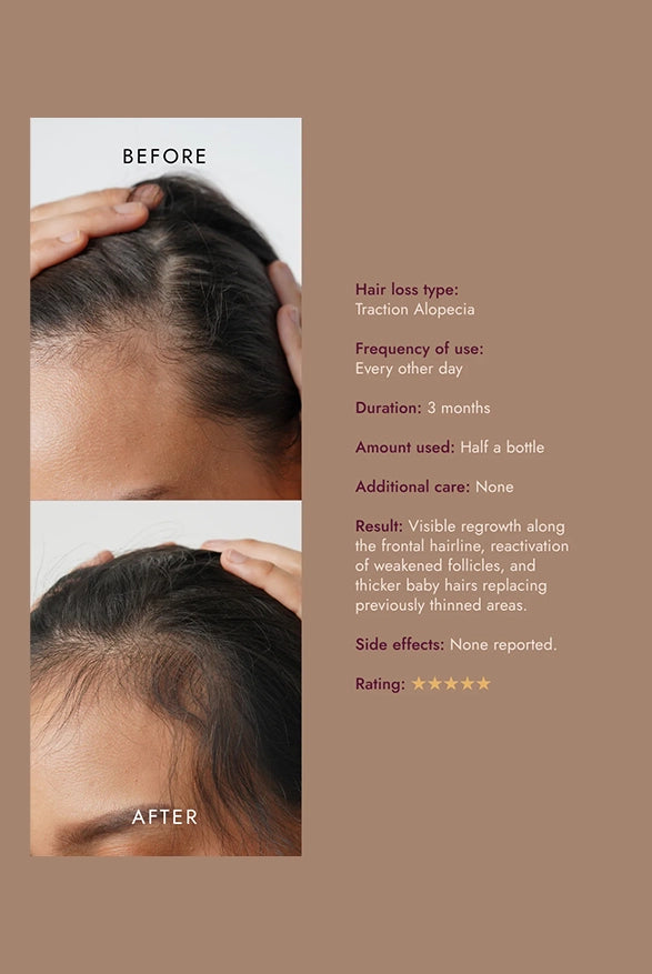 The Alpha Hair Serum