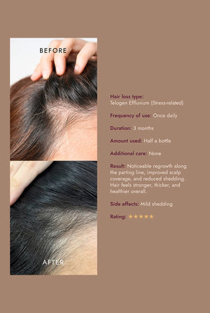 The Alpha Hair Serum